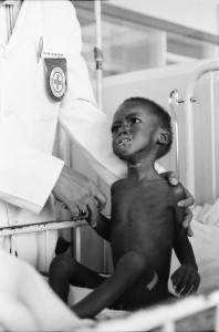 Das Bild zeigt ein ums Überleben kämpfendes Kind in Uganda nach dem Krieg zwischen Uganda und Tansania im Jahr 1980: Allein 800.000 Waisenkinder und 200.000 Witwen litten seinerzeit unter den Kriegsfolgen.